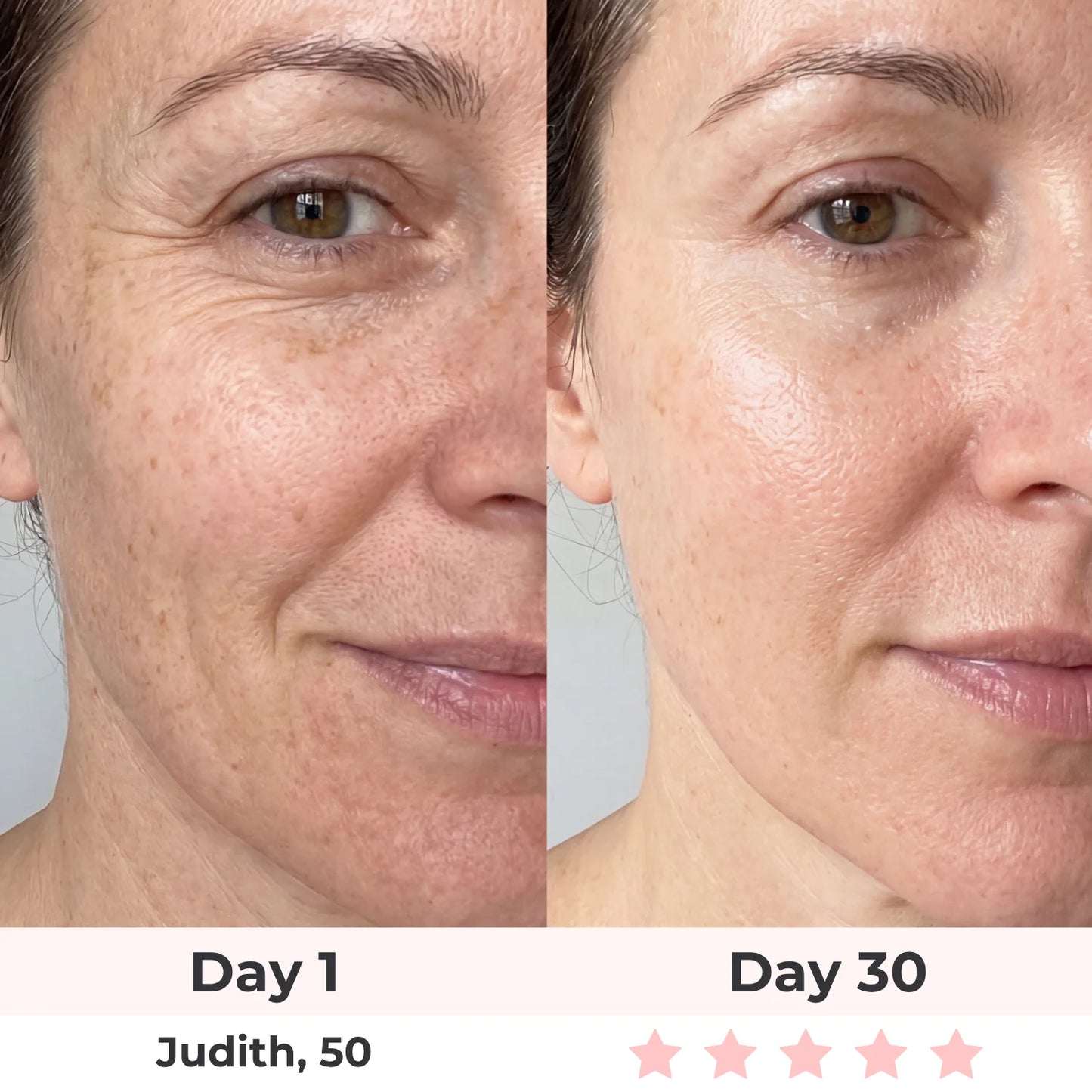 Anti-Aging Vitamin C Serum