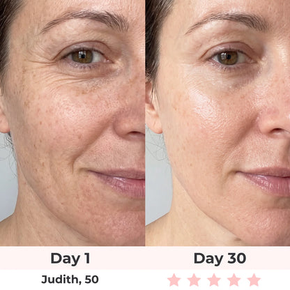 Anti-Aging Vitamin C Serum