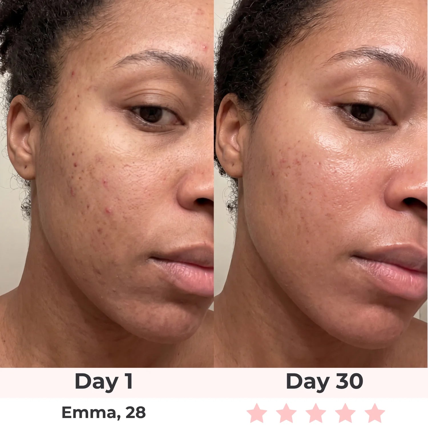 Lux Cove Skin Firming 5-In-1 Hyaluronic Acid Face Serum