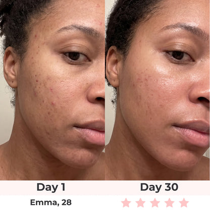 Lux Cove Skin Firming 5-In-1 Hyaluronic Acid Face Serum