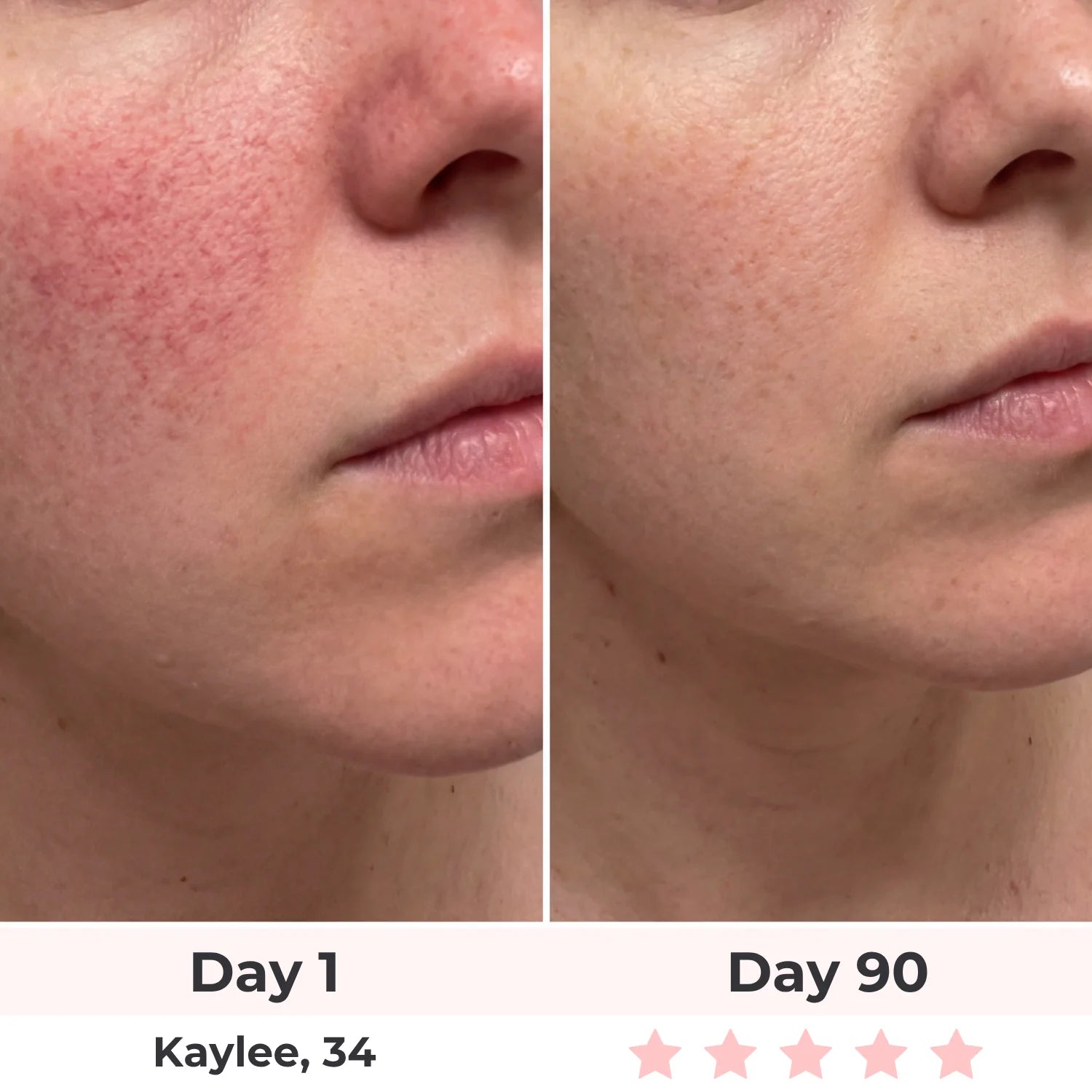 Lux Cove 7-In-1 LED Face Mask