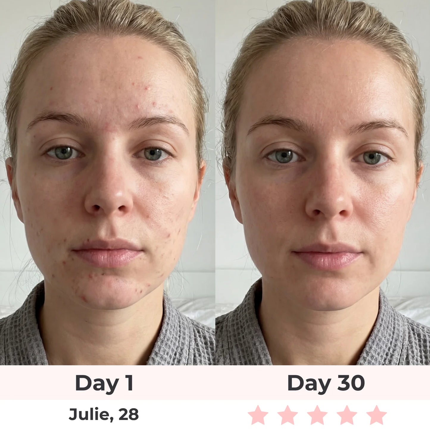 Lux Cove 7-In-1 LED Face Mask