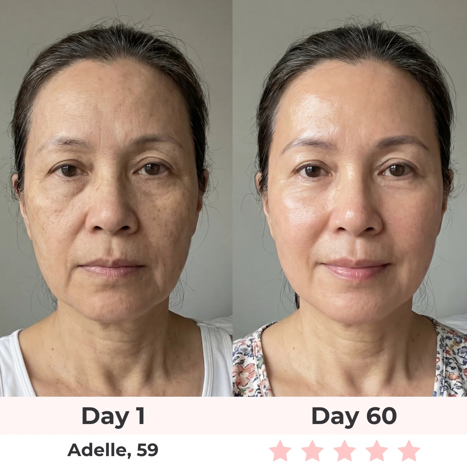 Lux Cove 7-In-1 LED Face Mask