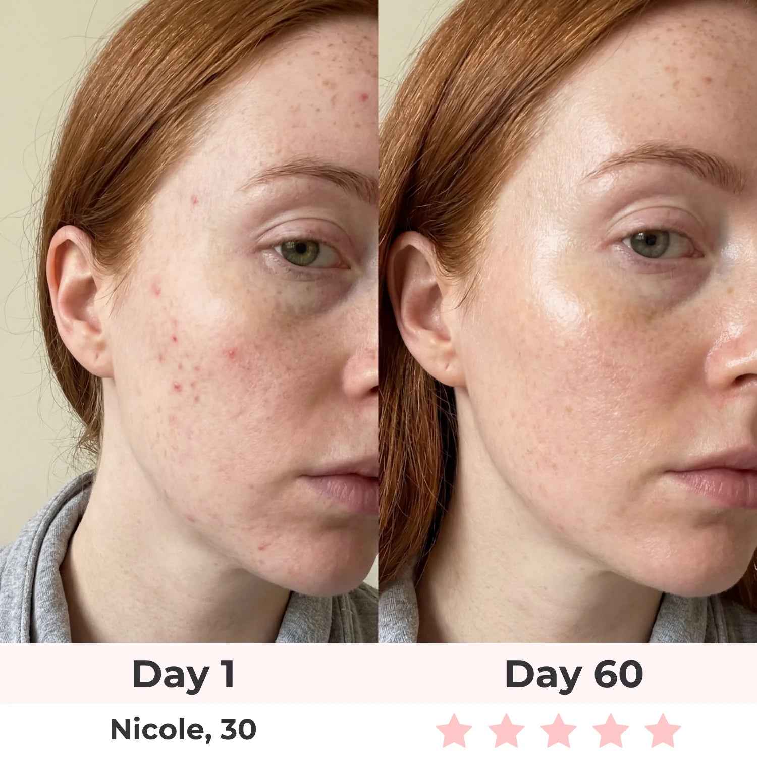 Anti-Aging Vitamin C Serum