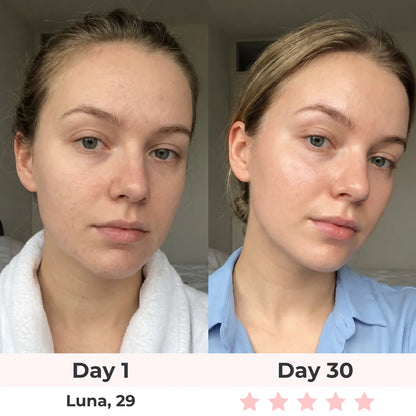 Anti-Aging Vitamin C Serum