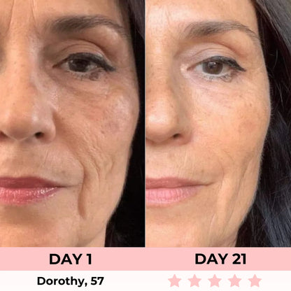 Kojic Acid Overnight Collagen Mask