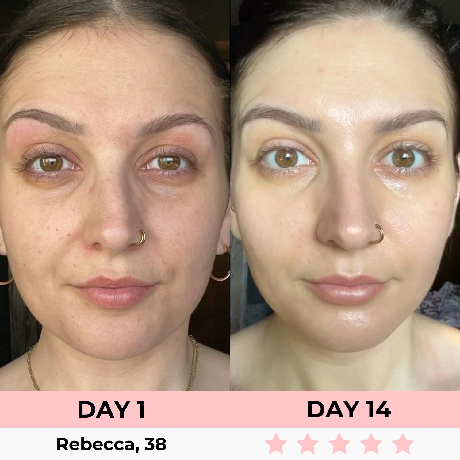 Kojic Acid Overnight Collagen Mask