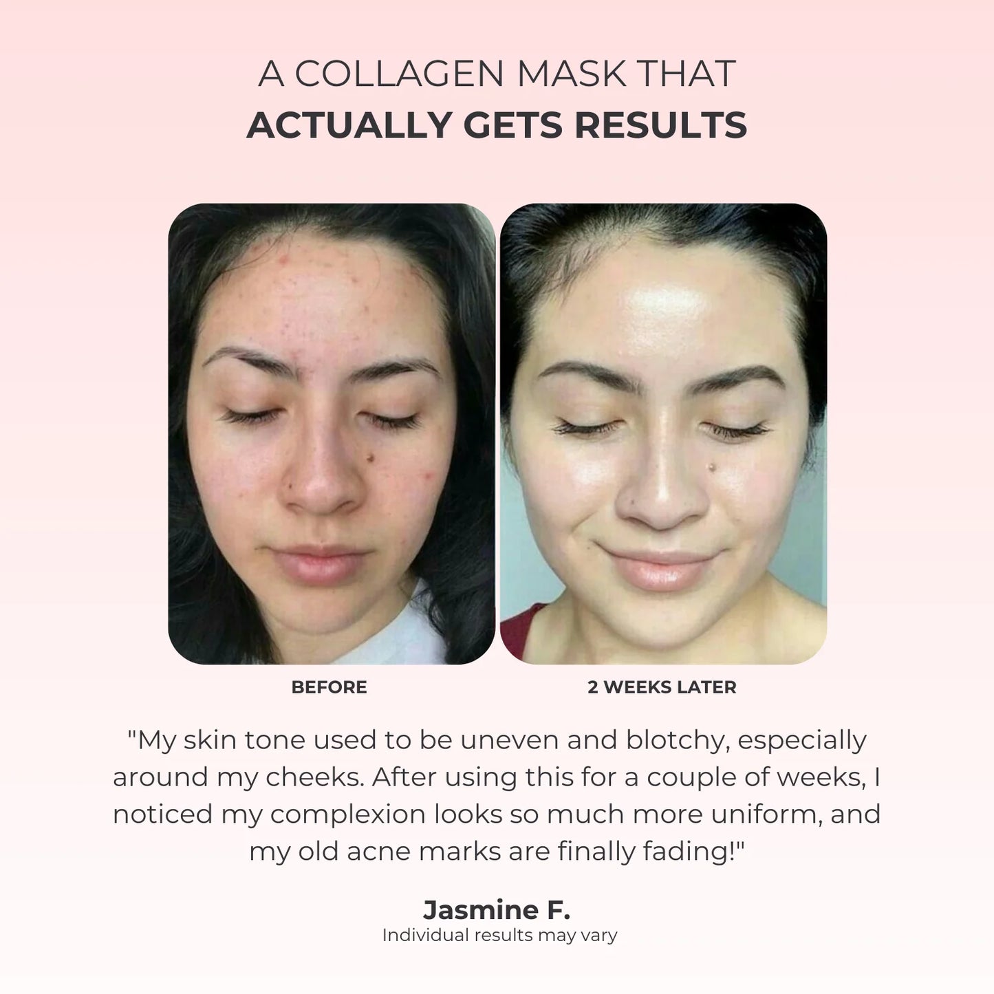 Kojic Acid Overnight Collagen Mask