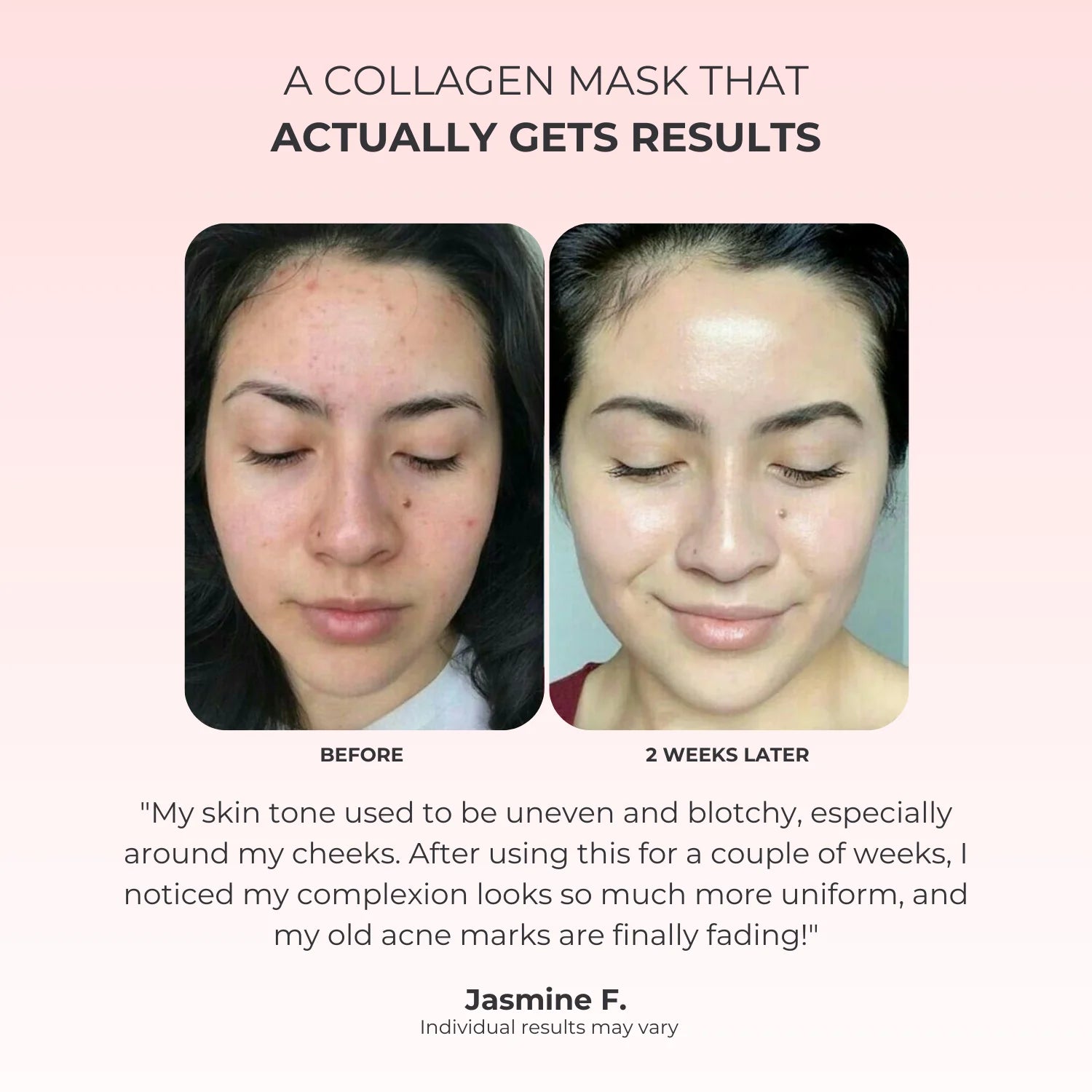 Kojic Acid Overnight Collagen Mask