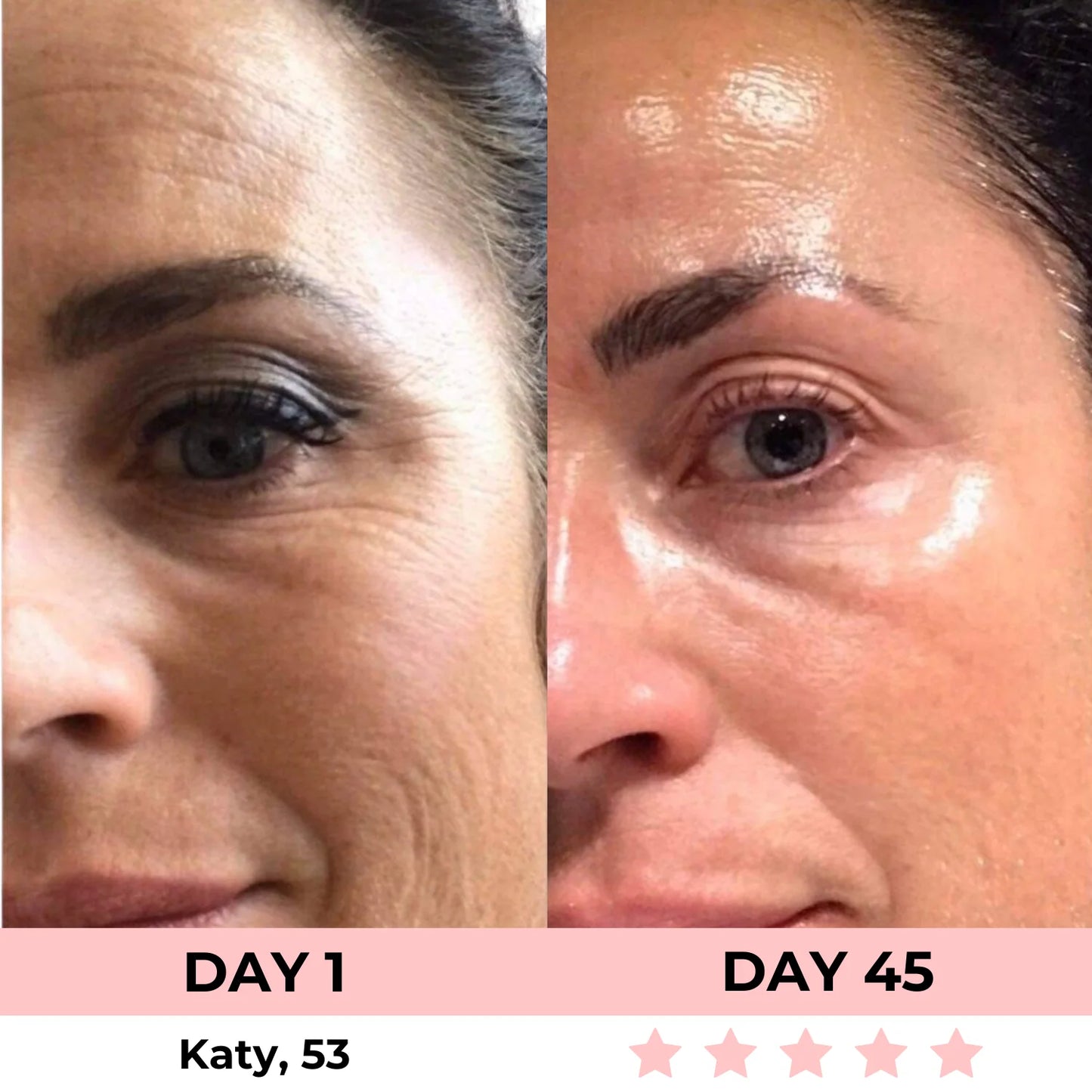 Kojic Acid Overnight Collagen Mask