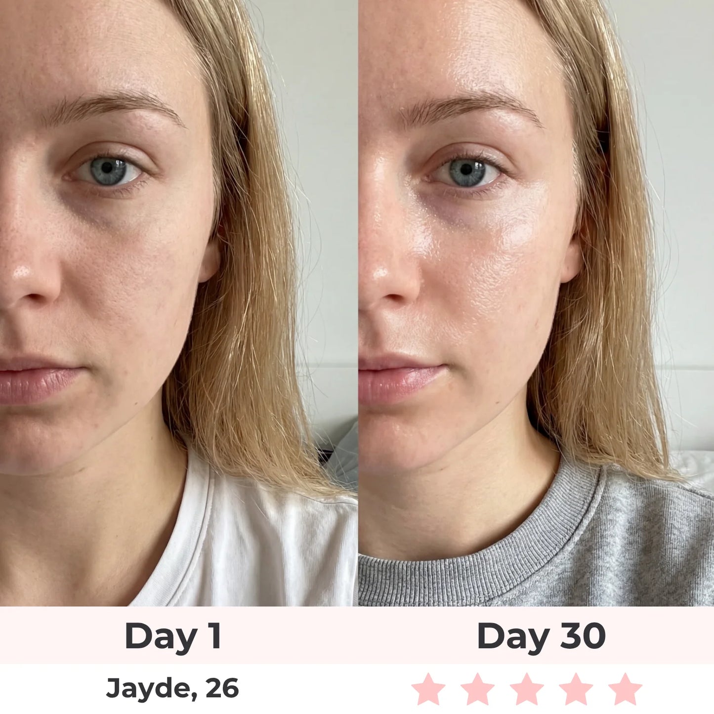 Anti-Aging Vitamin C Serum