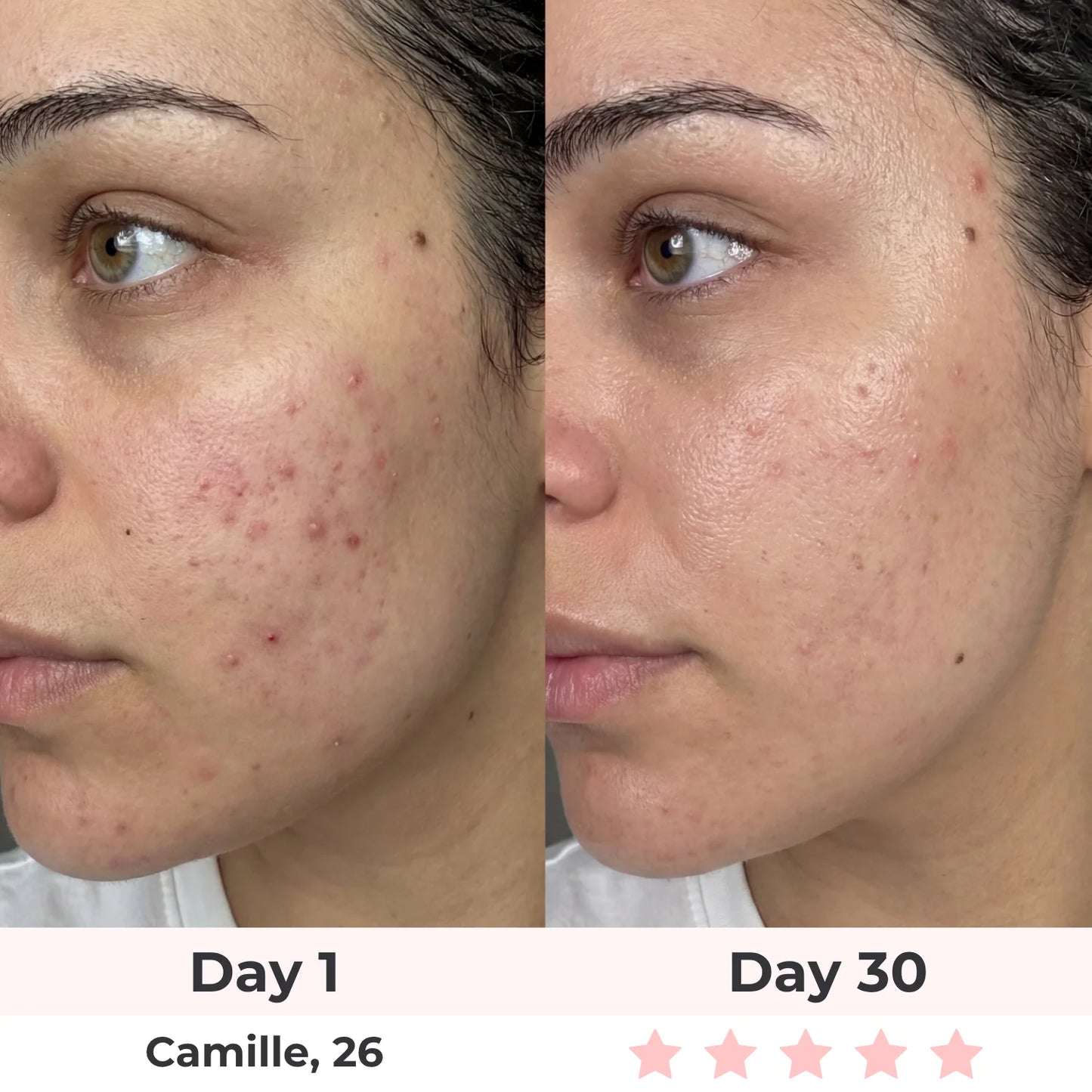 Lux Cove Skin Firming 5-In-1 Hyaluronic Acid Face Serum