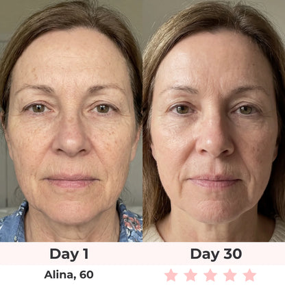 Anti-Aging Vitamin C Serum