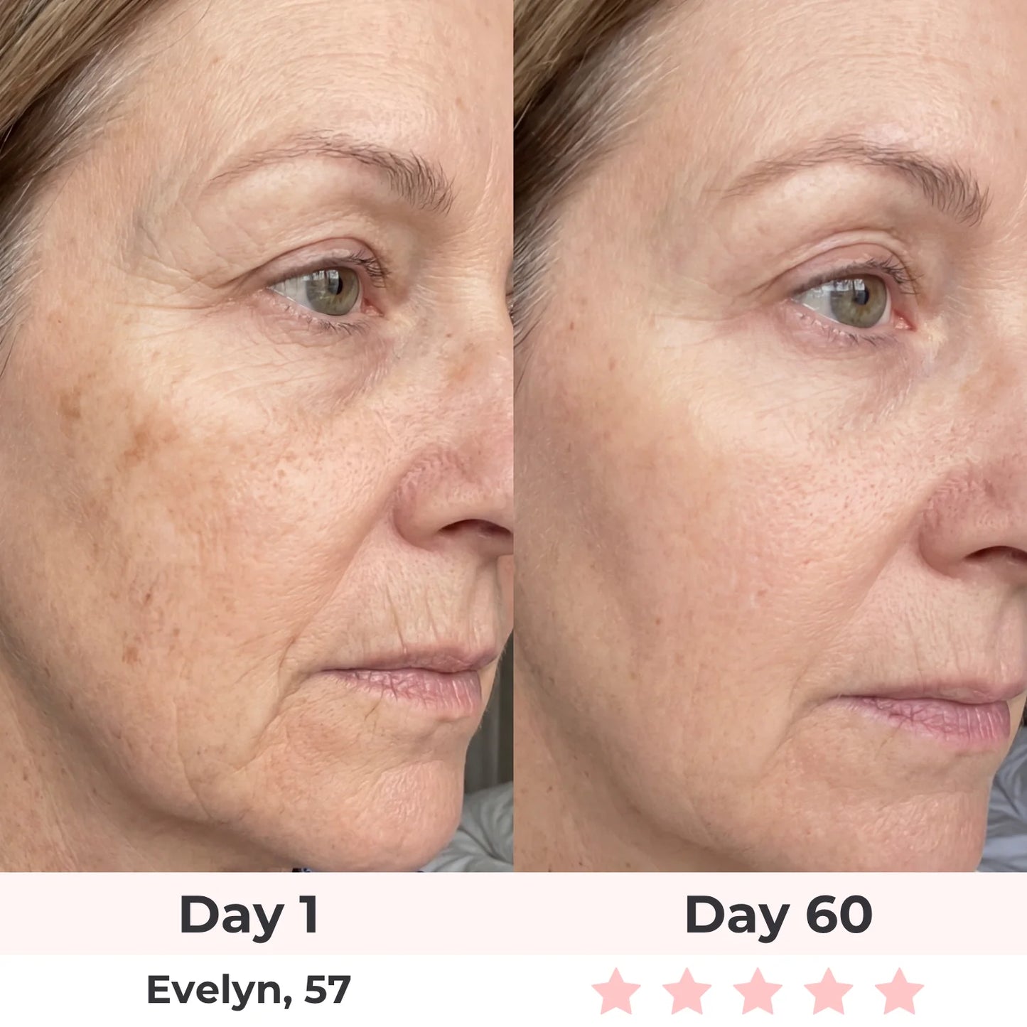 Anti-Aging Vitamin C Serum