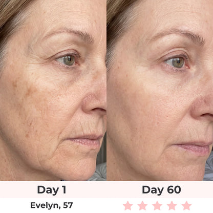 Anti-Aging Vitamin C Serum